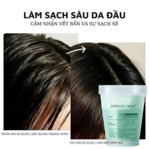 tẩyda chếtđầu